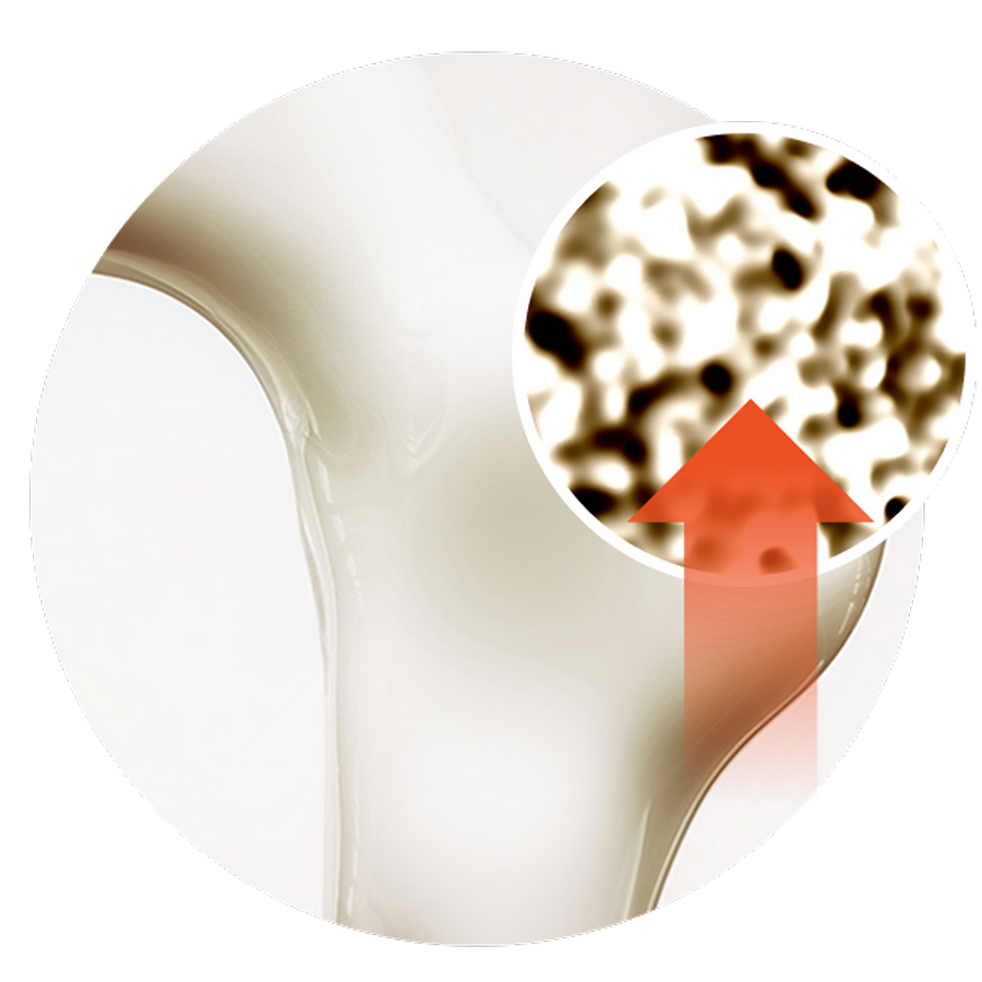 Research on Bone Matrix Support